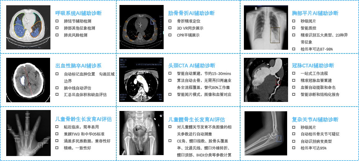 医疗智能辅助诊断产品.png 医疗智能辅助诊断产品.png